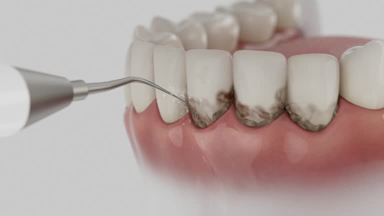Reliable Teeth Cleaning And Checkup contractor in Caribou County County, ID by Dentist Open Now